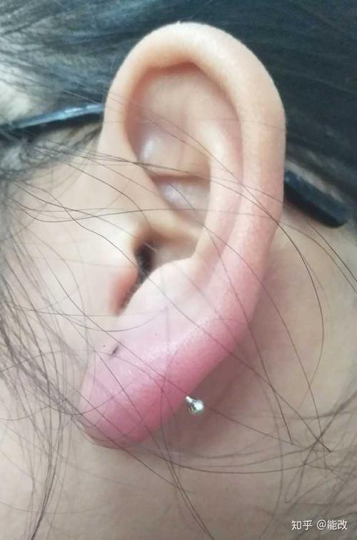厚耳垂打耳洞是一种什么样的体验,会很疼吗?