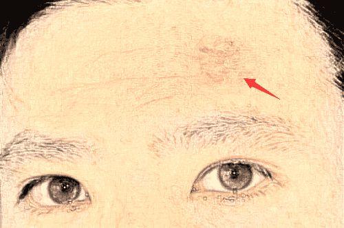 一,额头有疤痕额头代表着一个人的前途和事业发展运势,在面相中称为