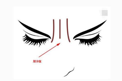 女人眉间八字纹面相解说女人眉间有纯八字纹易与丈夫感情不好眉间川字