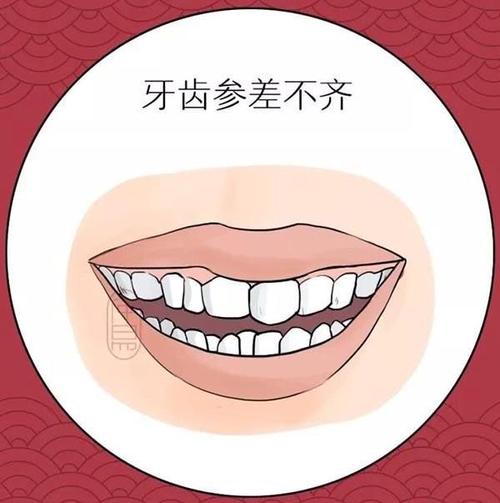 面相趣读丨几种常见牙齿类型,哪种有福?