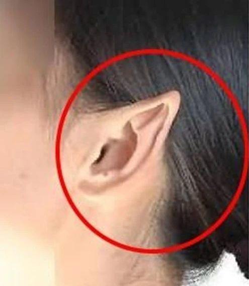 鼠耳指的是耳朵没有耳轮,耳朵偏小的类型,在面相上,我们说这样的人