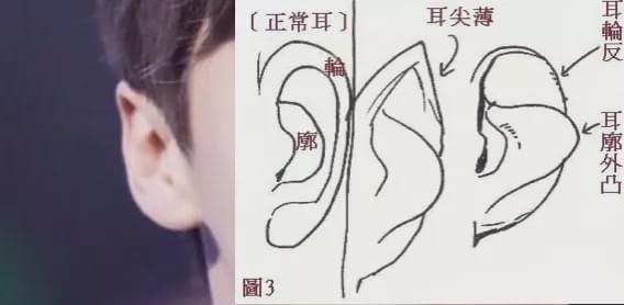男方的耳型属于典型耳尖薄 反耳,相不独论,结合面相来看,其实他内心