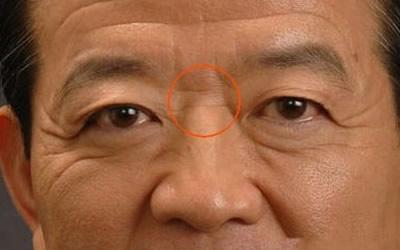 眉心有横纹面相分析 眉毛上面横纹面相图解