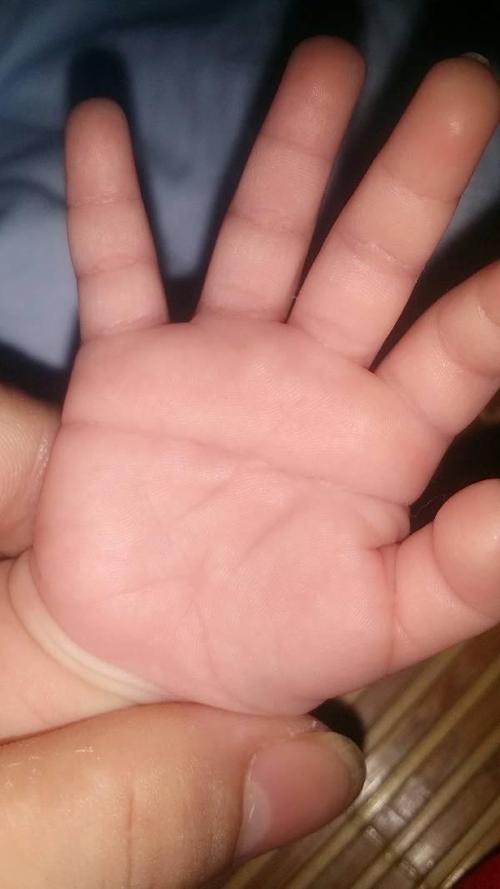 小宝宝手掌有横纹代表智力有问题来看看关于掌纹的秘密