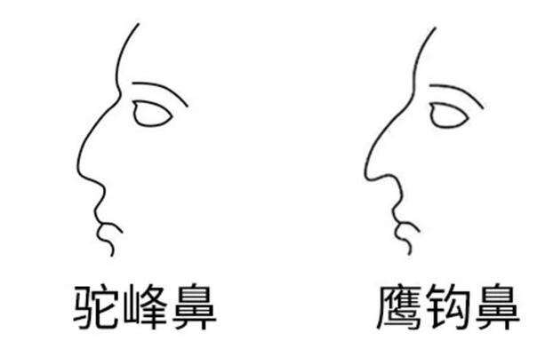 相学 面相 驼峰鼻的特征是鼻梁比较宽,下端比较肥大,鼻尖长够壮和