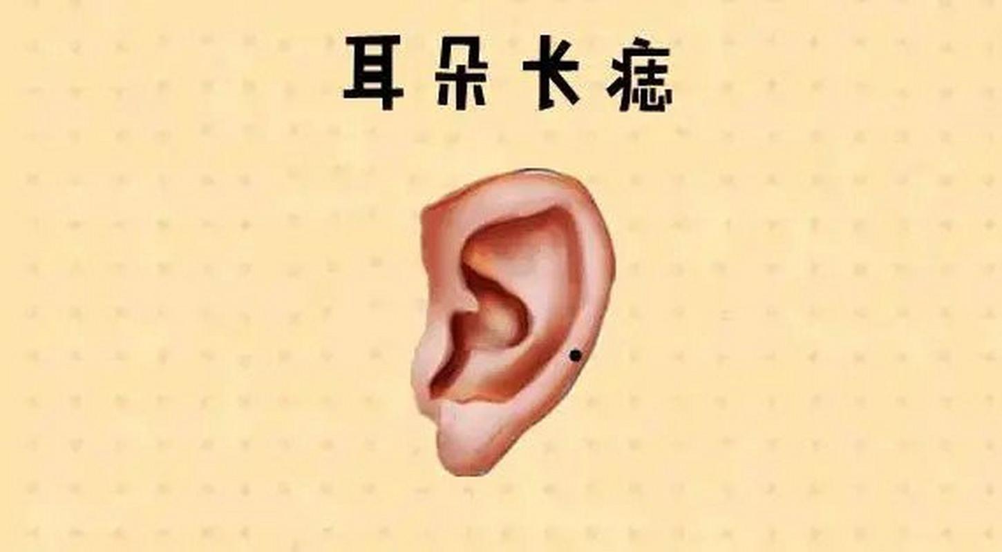 耳朵长痣  耳朵代表的是一个人的福气与财运等,若是耳朵的位置处长有