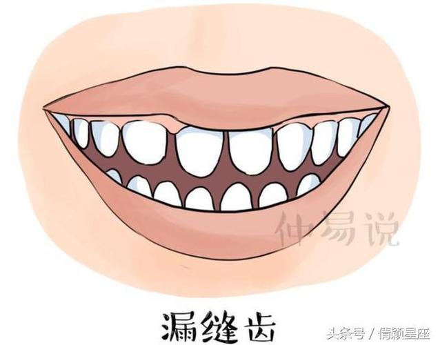 「牙齿面相」这三种牙齿的人需敬而远之,特别要注意最后一种