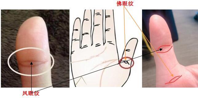 而凤眼纹长在双手大拇指中间关节处,也是以呈眼睛形状得名.